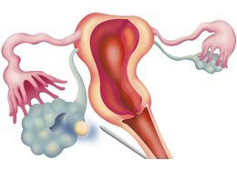 Gamete Intrafallopian Transfer (GIFT)