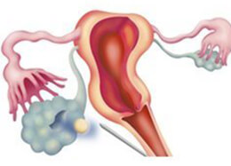 Zygote Intrafallopian Transfer (ZIFT)