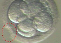 Laser Assisted Hatching (LAH)