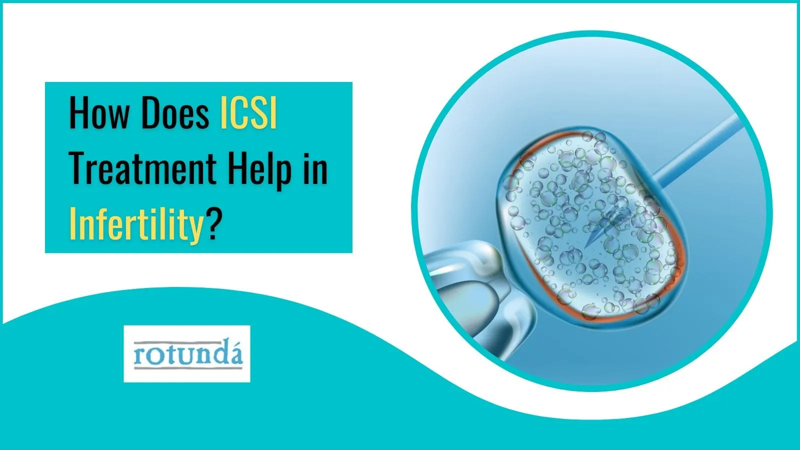 How Does ICSI Treatment Help in Infertility?
